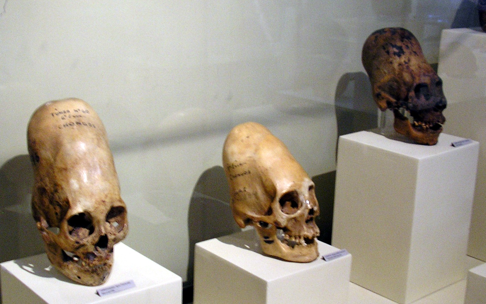 Crânes d&ecute;formés du peuple Paracas au Pérou, au musée d'Ica.