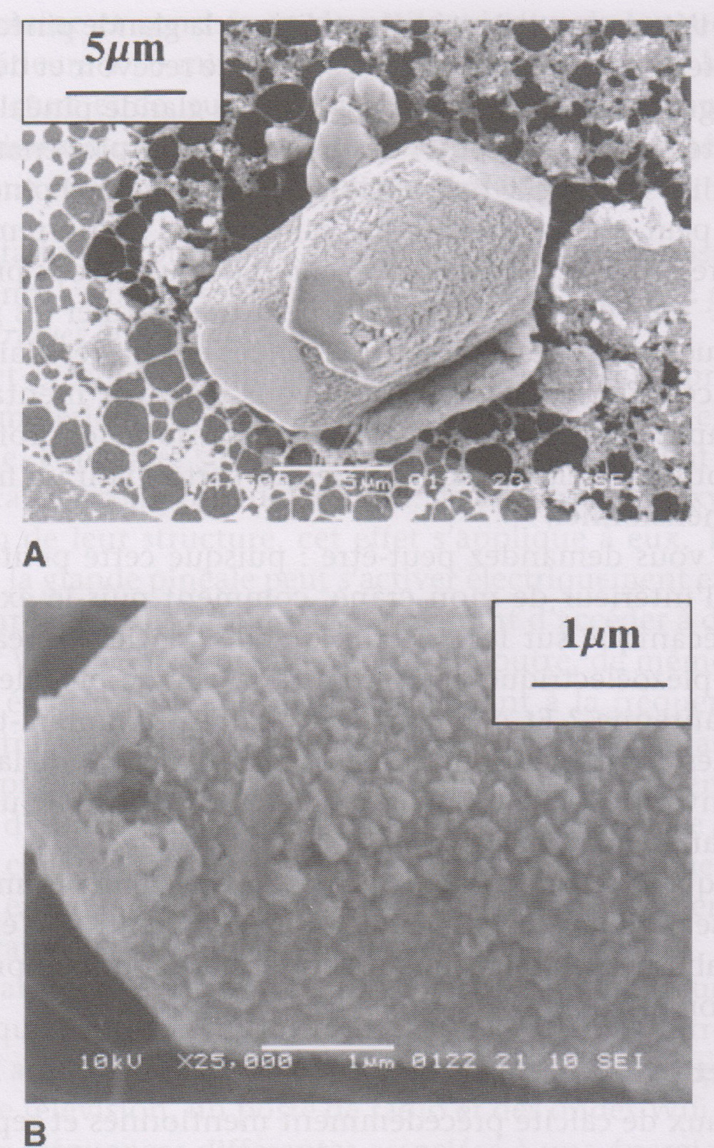 Glande pinéale & cristaux de calcite de 20 microns.