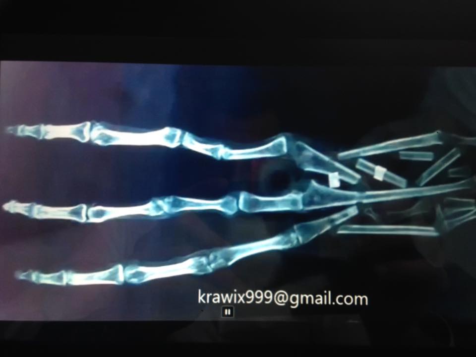 Humanoïde à trois doigts, et sept phalanges.