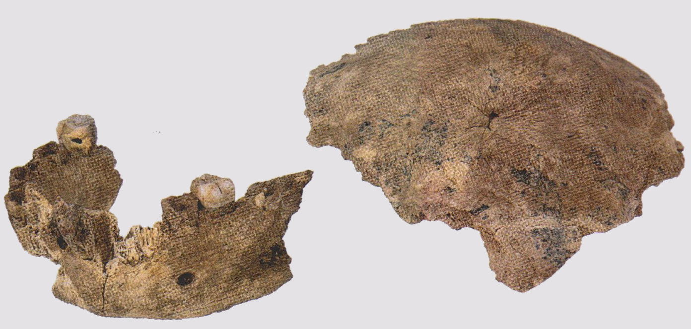 Fragments de l'os pariétal et le corps de la mandibule fragmentaire