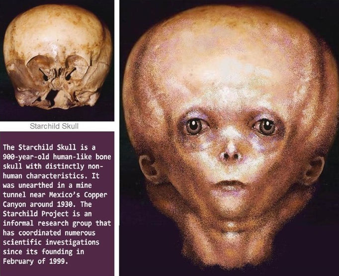 Starchild